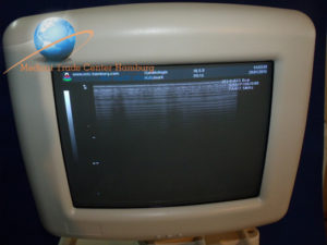 SONOACE Medison HL5-9 linear array ultrasound transducer probe.