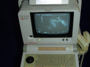 Picker EUB-405 CS-9100 Ultraschallgerät